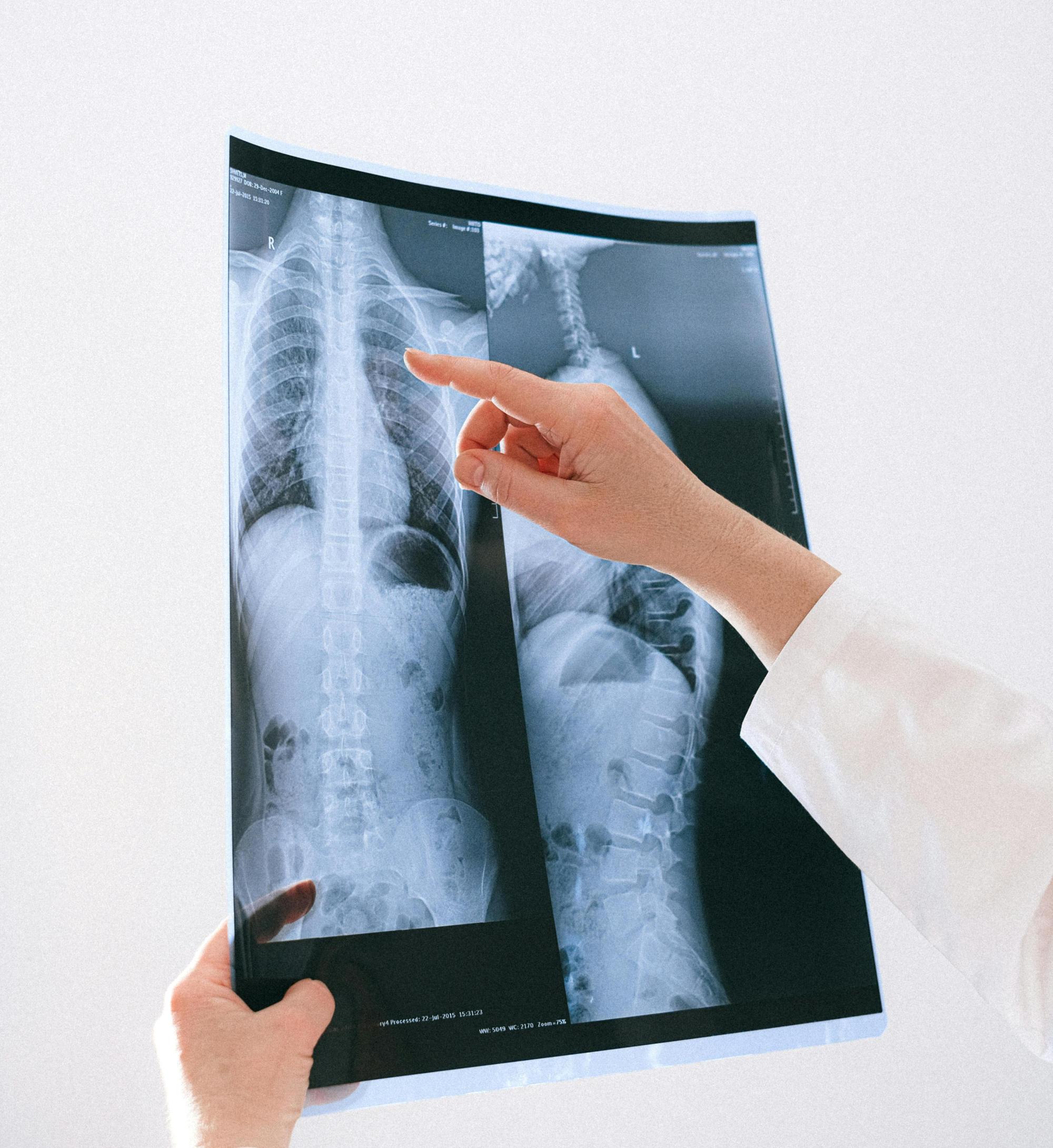 Phthisiology (adult, children's)